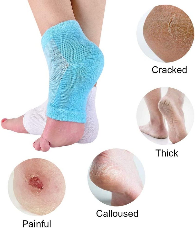 CGBOOM Moisturizing Gel Heel Socks Vented Unisex Day Night Toe Open Feet Care Dry Skin (2P_BlueWhite) - Image 2